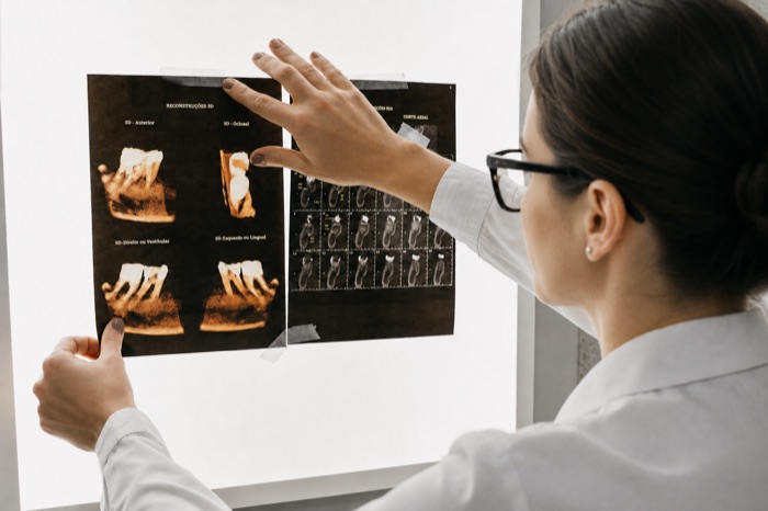 Analyse d'une radiographie 3D lors d'un bilan dentaire chez Clear Smile