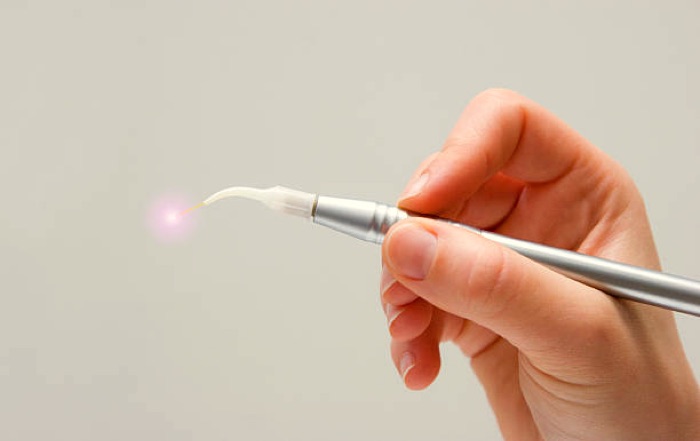 Pièce à main du laser diode utilisé pour les soins parodontaux