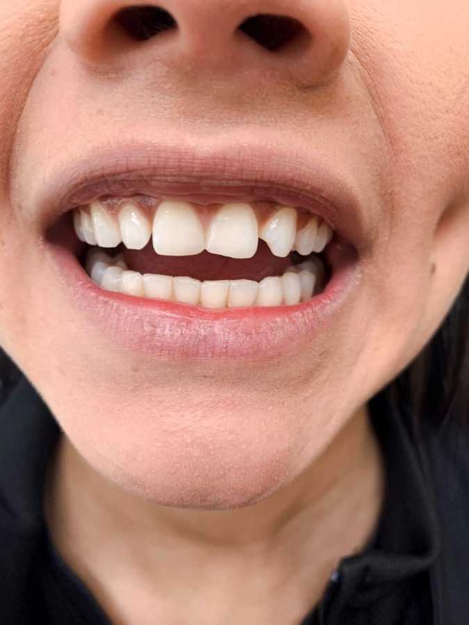 Exemple de photo trop rapprochée, cadrée uniquement sur la bouche